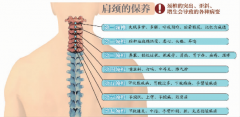 他吃饭噎住竟然是颈椎病引发 别再做“低头族”了