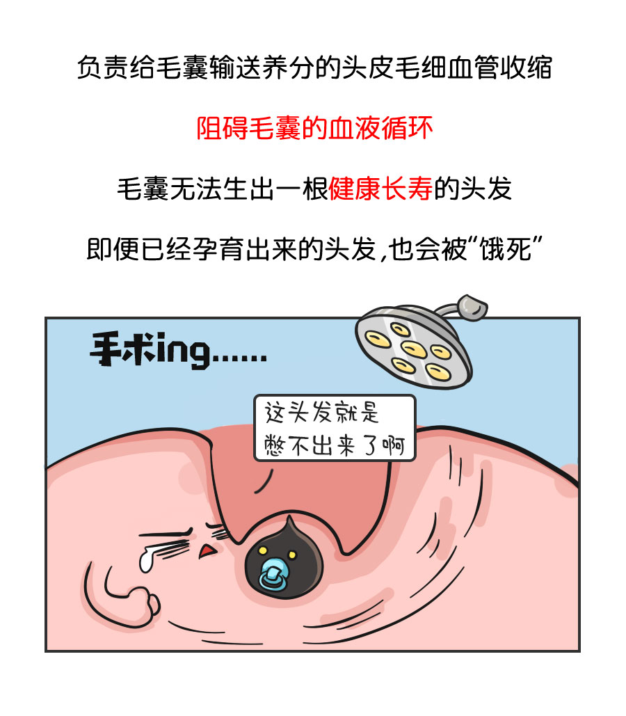 我们为什么会脱发？