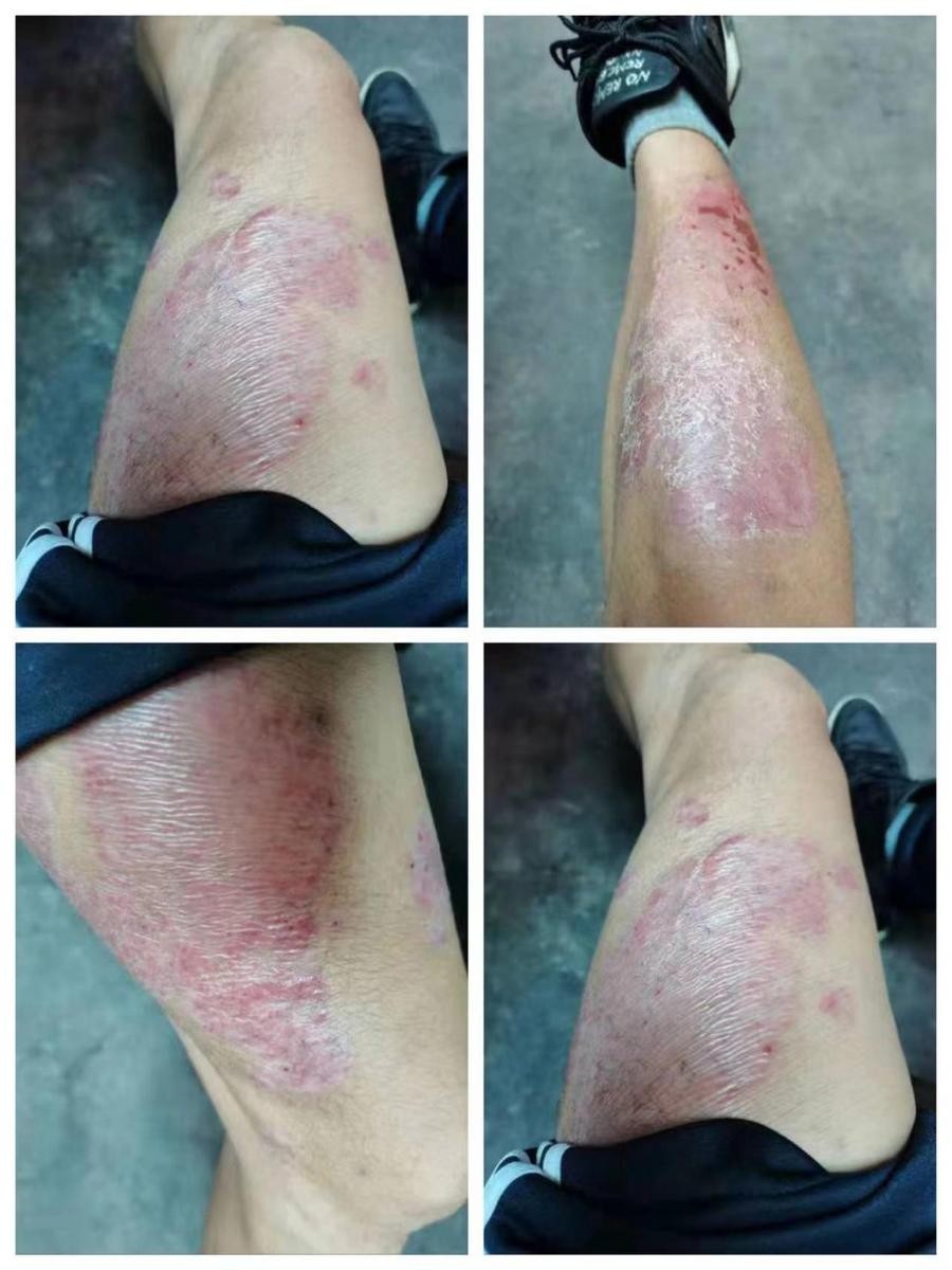 http://drdbsz.oss-cn-shenzhen.aliyuncs.com/220513115310829124714.jpeg